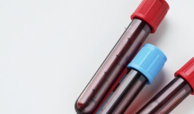 Blood testing at the Clinic: services severely limited